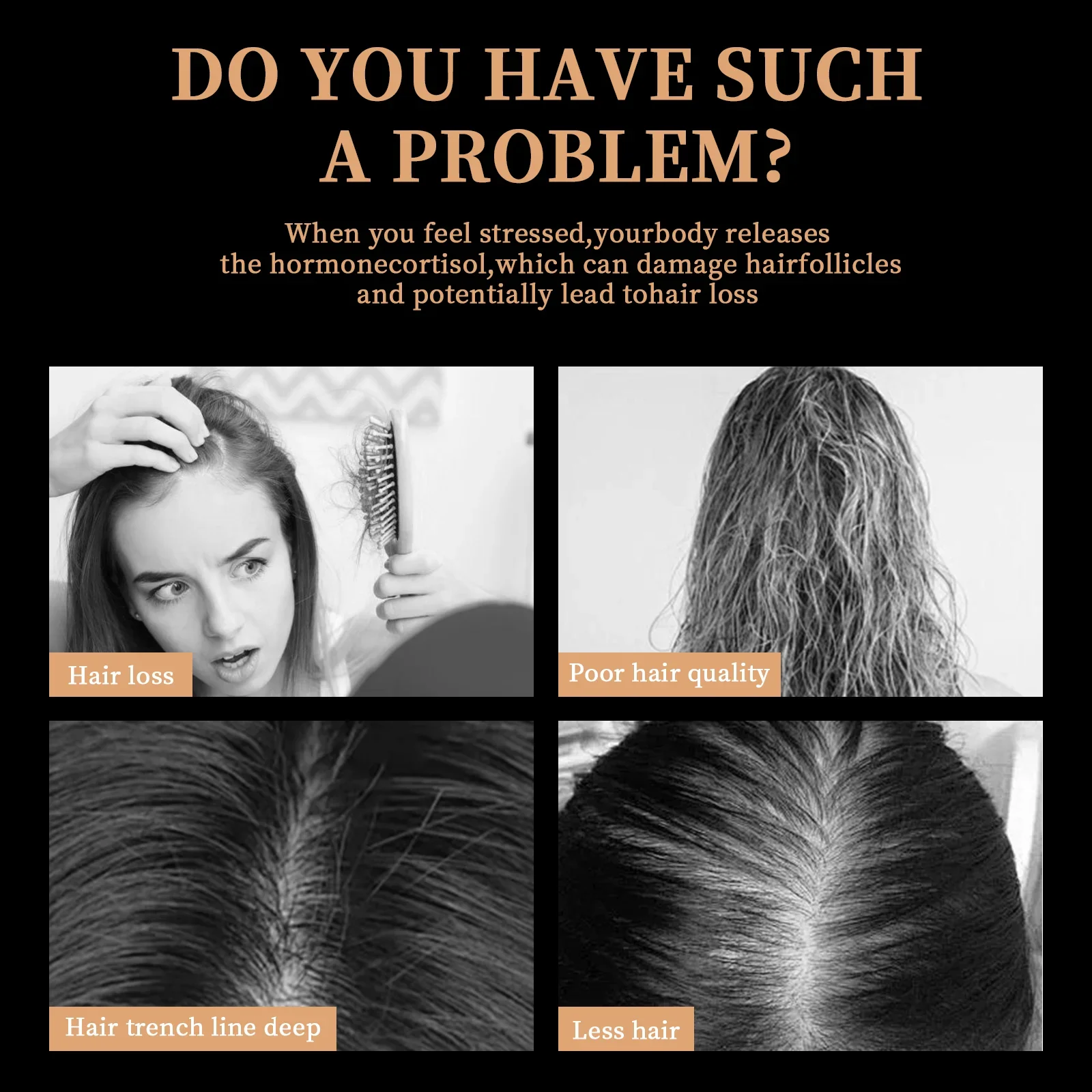 شامبو إعادة نمو الشعر شامبو سماكة الجذر المنشط شامبو رقيق تغذي العناية لتخفيف الشعر شامبو مضاد لتساقط الشعر #4