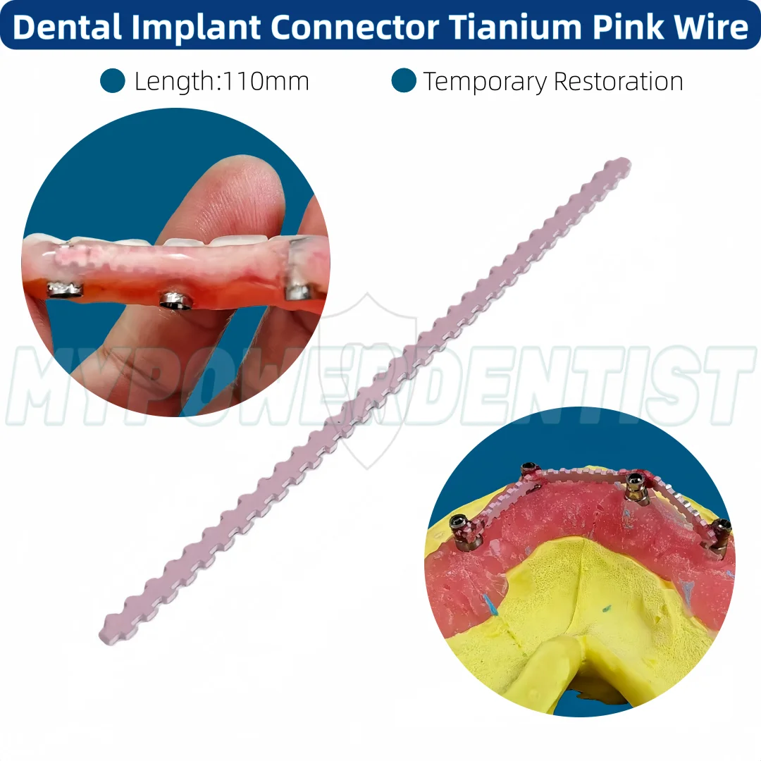 

Dental Implant Titanium Wire Denture Temporary Restoration Transfer Rod Fixed Pink 110mm