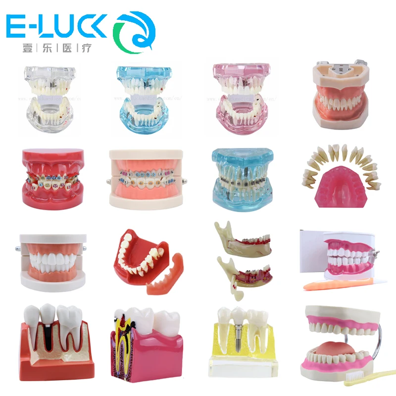 

Dental Teeth Model Multiple Types Teaching Typodont Orthodontic Model eaching Study Medical Science Disease Dentistry Products