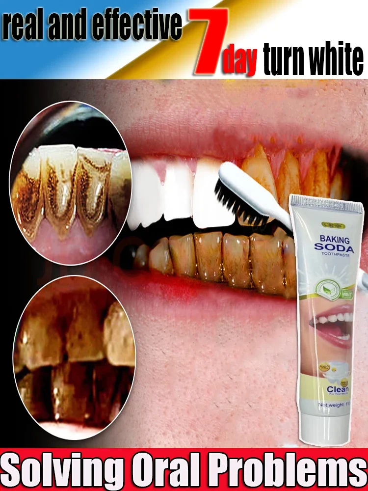 Remover Dental Calculus Whitening Teeth Mouth Odor Removal Bad Breath Preventing Periodontitis