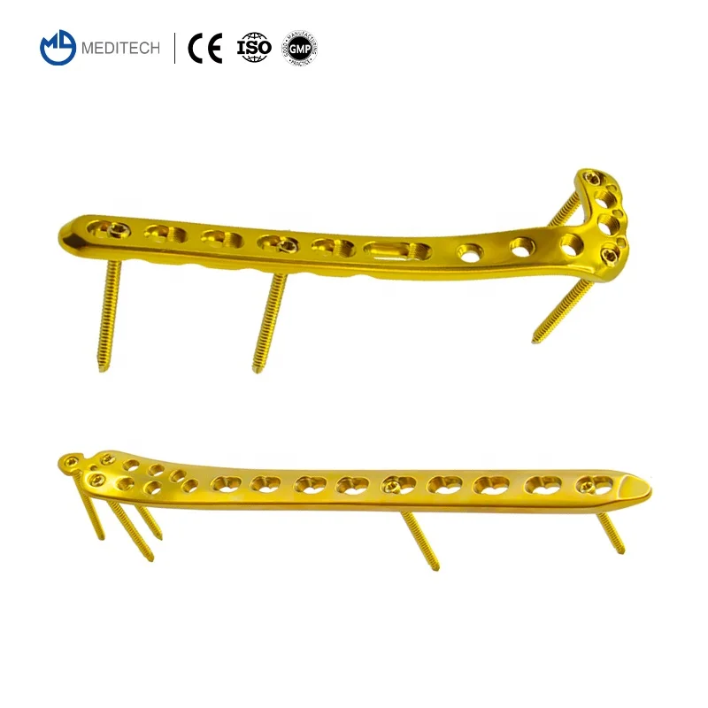 Titanium surgical implants proximal and distal tibial medial and lateral locking plates