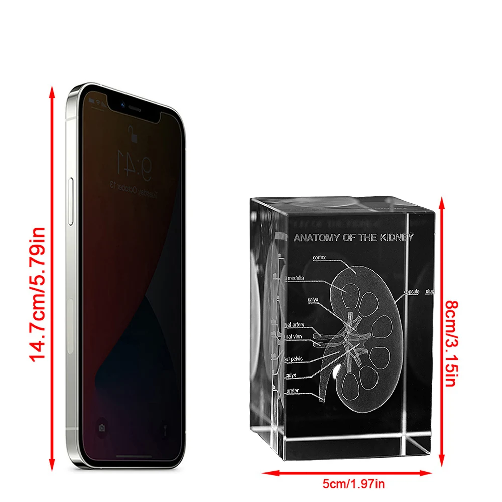 Crystal 3D Engraved Human Anatomical Kidney Model Statue Medical Student Christmas Gift Nephrology Department Specialist Trophy