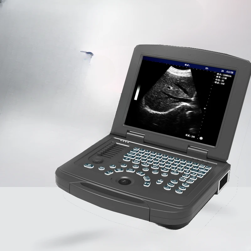 

Portable medical ultrasound machine for black and white pregnant women going to rural areas for examination