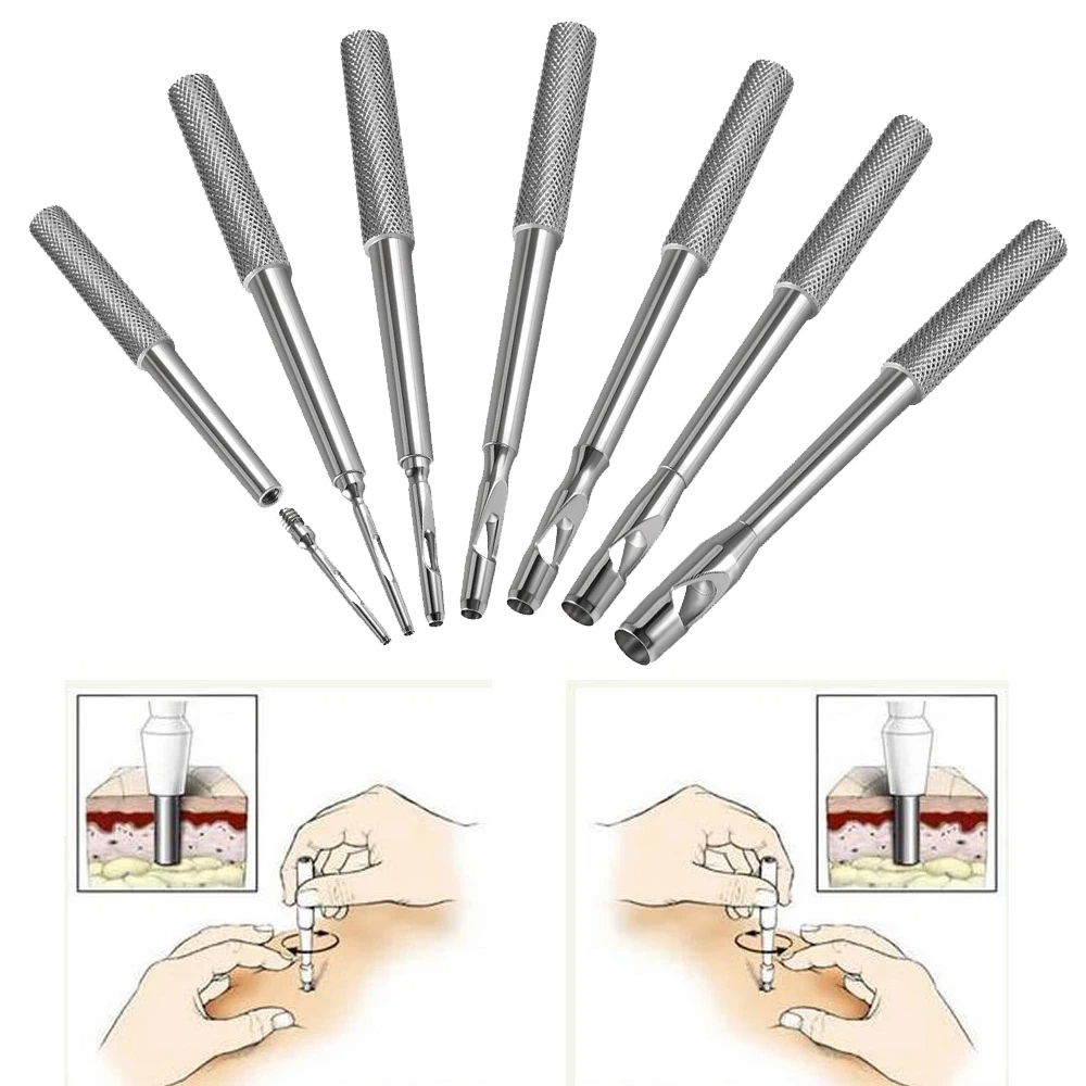 Punção Dérmica Esterilizada para Biópsia, Ferramenta Profissional de Piercing Corporal, Fácil de Usar, Punção Dérmica Esterilizada para Piercing de Pele 1.5mm-6mm