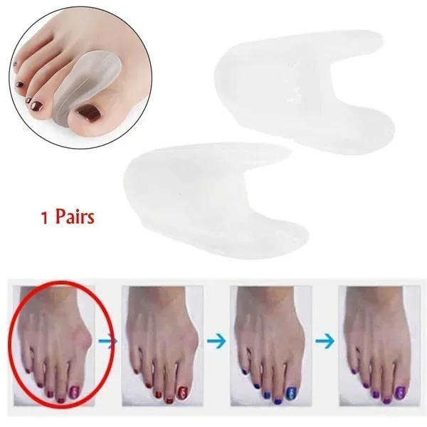 Delysia King 2Pcs Silicone Toe Separator