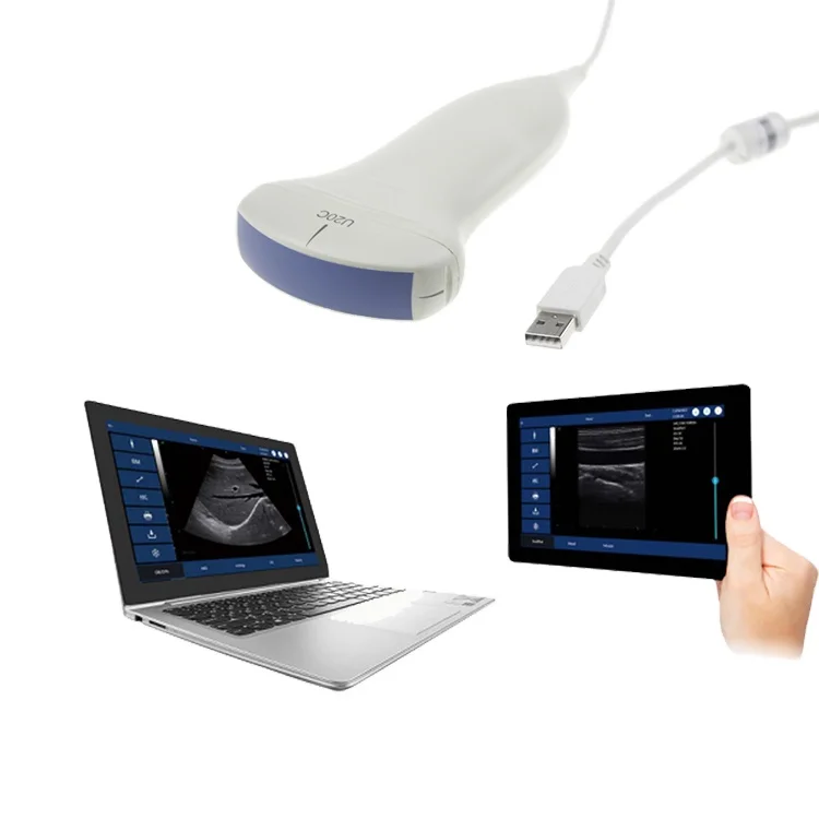 Free shipping Upgrade Diagnosis USB convex array Probe Ultrasound Machine+free ultrasound software