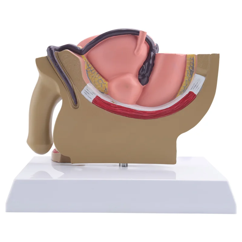 VO-1:2 Sezione Sagittale pelvica maschile Modello del sistema urinario rettale della vescica della prostata testicolare