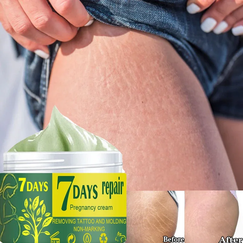 30/50g Removes Stretch Mark Cream To Remove Postpartum Obesity Pregnant Women Repair Anti-Aging Anti-Winkles Firming Body Cream