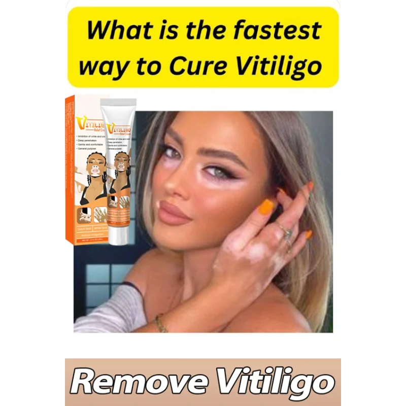 

ⁿⁱᶜᵉ Remove Ringworm White Spot Removal Skin Vitiligo