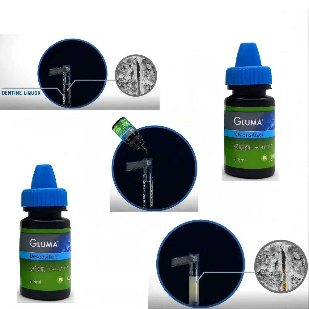 Kulzer GLUMA Desensitizer Professional Dental Sensitivity Relief Solution Instant Pain Treatment for Exposed Dentin 5ml Bottle