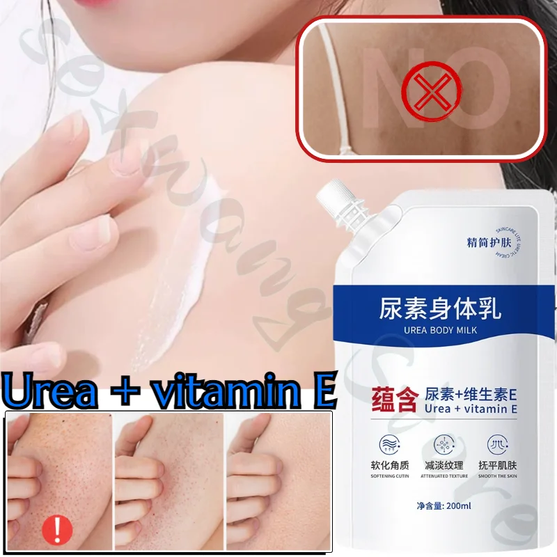 

Vitamin E Urea Cream Body Lotion Moisturizing Non-drying Vitamin Softening Cuticle Body Lotion Available for All Seasons 200ml