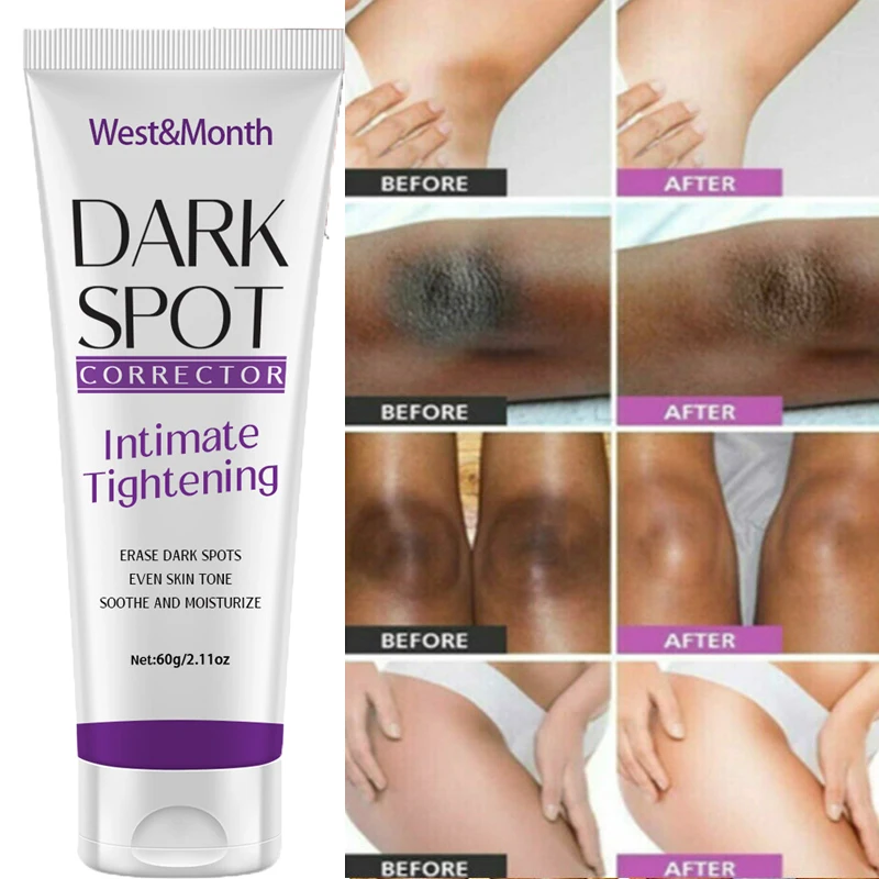 Nicotinamide Brightening Cream For Dark Skin Effective Lighten Thigh Inner Bleach Remove Melanin Private Parts Brighten Cream