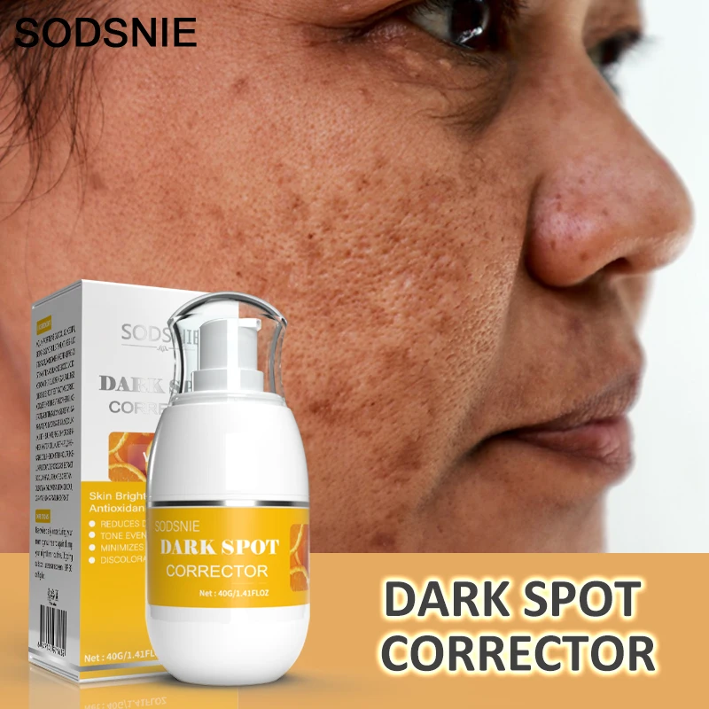 

Vitamins Remove Dark Spots Lighten Sun Spots Freckles Melasma Pigmentation Whitening Cream Anti-Aging Brightening Skin Care 40g