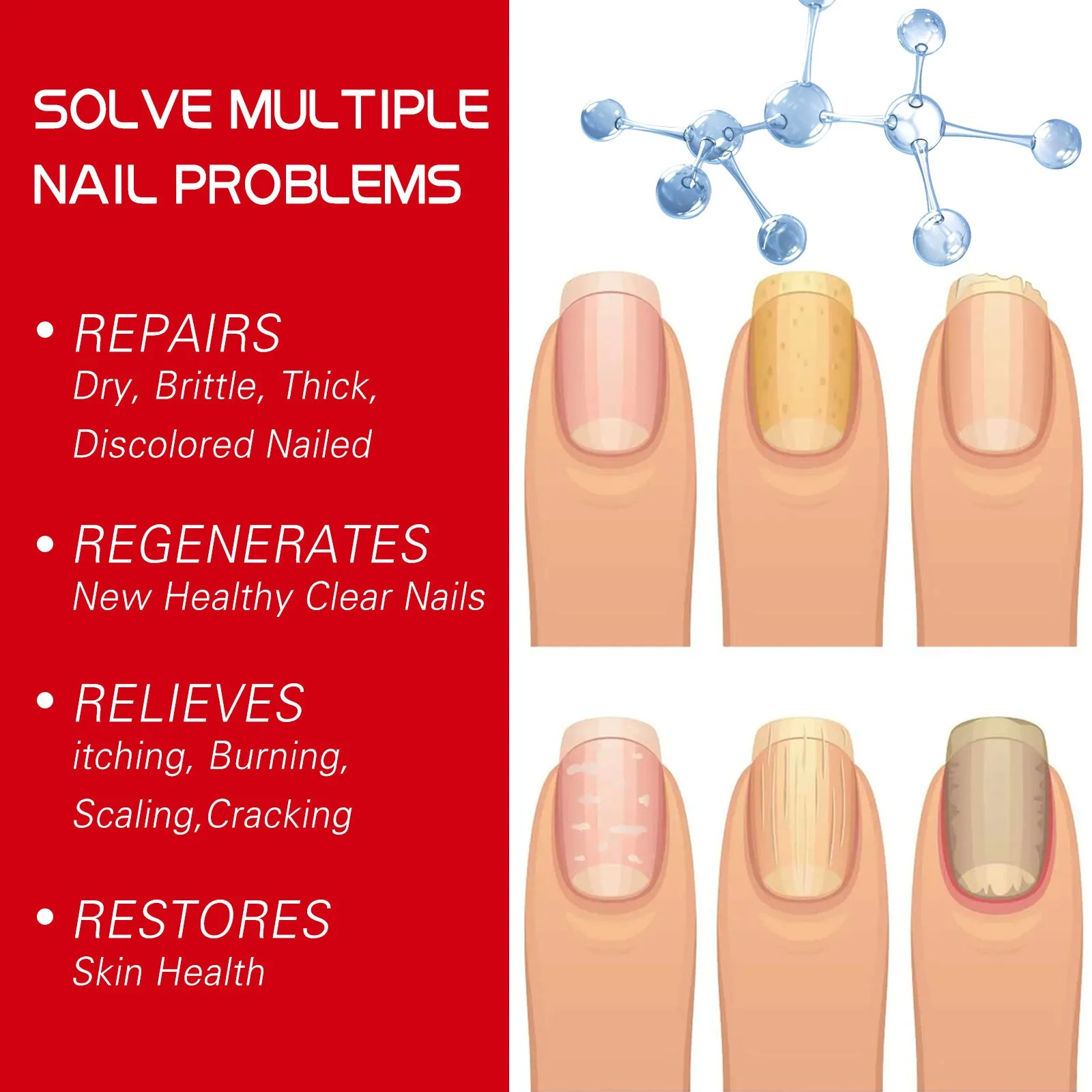 Nagelpflegeflüssigkeit, repariert Vergilbung, graue Fingernägel, Zehennägel, verdickt die Nägel, verhindert Nagelrotten, Nagelpflege-Essenz, 20 ml, sicher