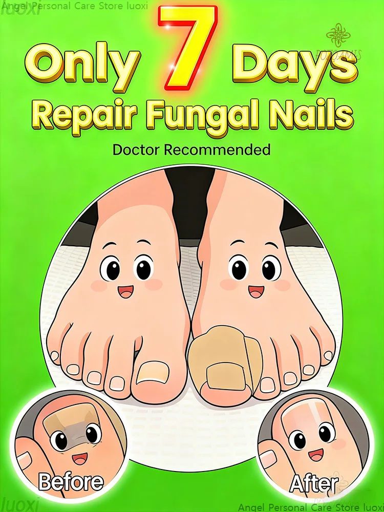 Rᴇᴘᴀɪʀ sᴛɪᴄᴋᴇʀs, can be used to repair your nails, easy and quick to use, non-greasy