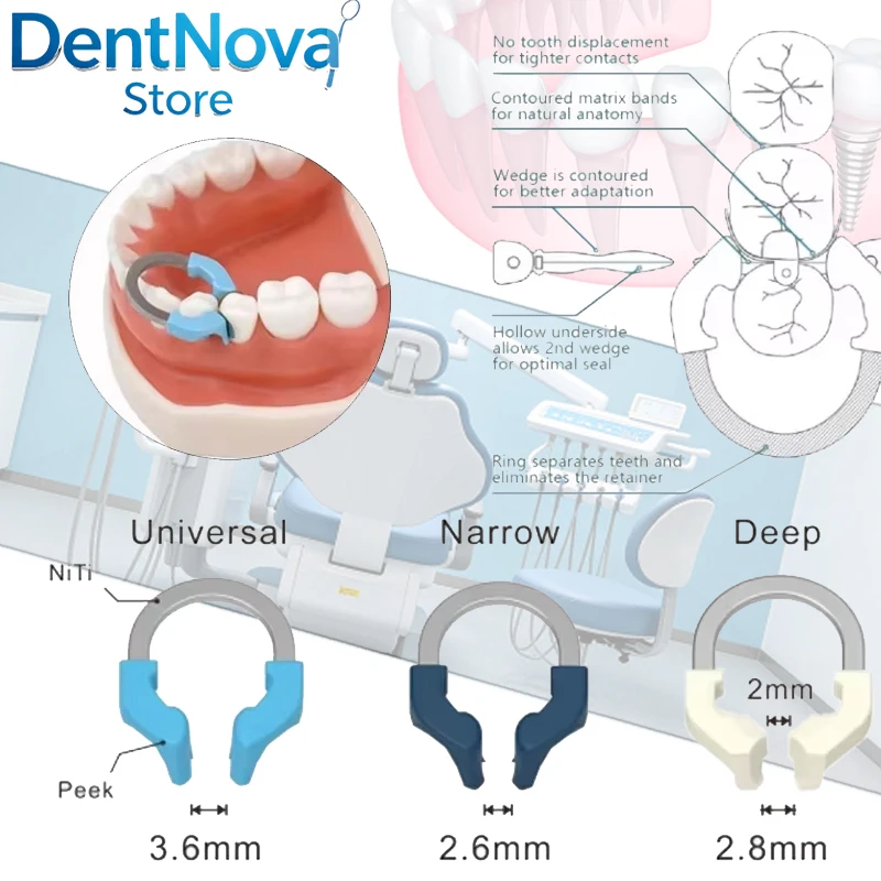 

NiTi Clamp Dental Matrix Bands Narrow Metal Matrix System for Molar Restoration Durable Orthodontic Tools Sectional Set