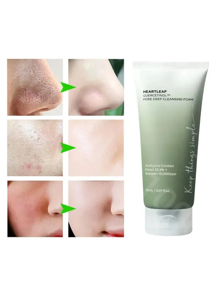 ANUA - Heartleaf Quercetinol Pore Deep Cleansing Foam - 150ml Suitable for acne-prone skin