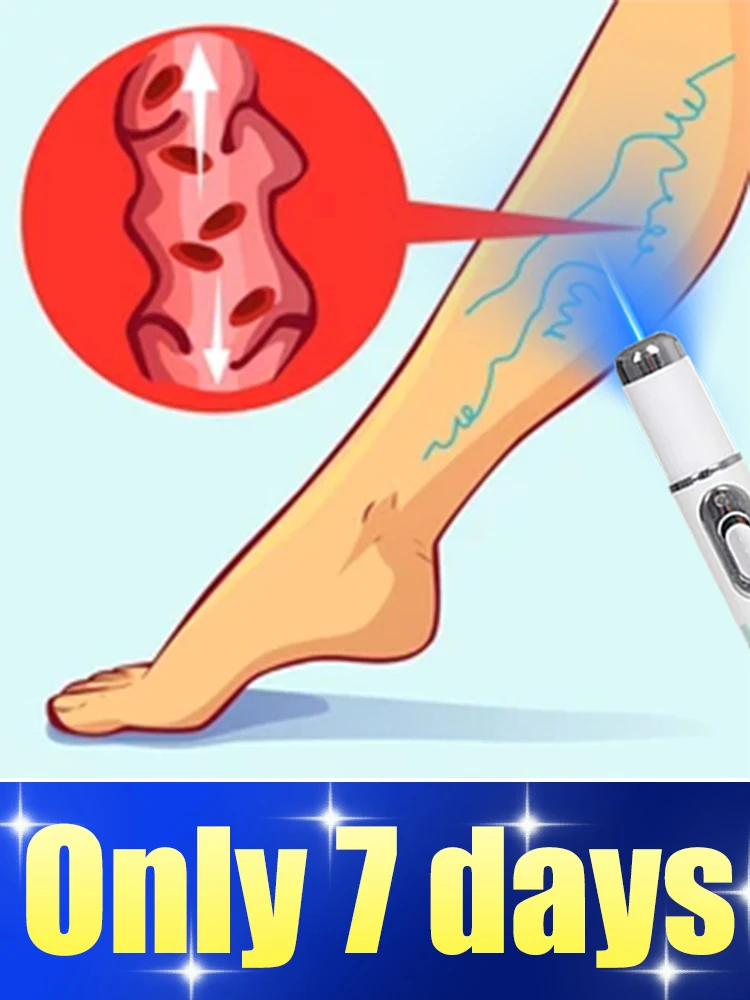 

Blue light pen, specializing in earthworm legs with protruding veins