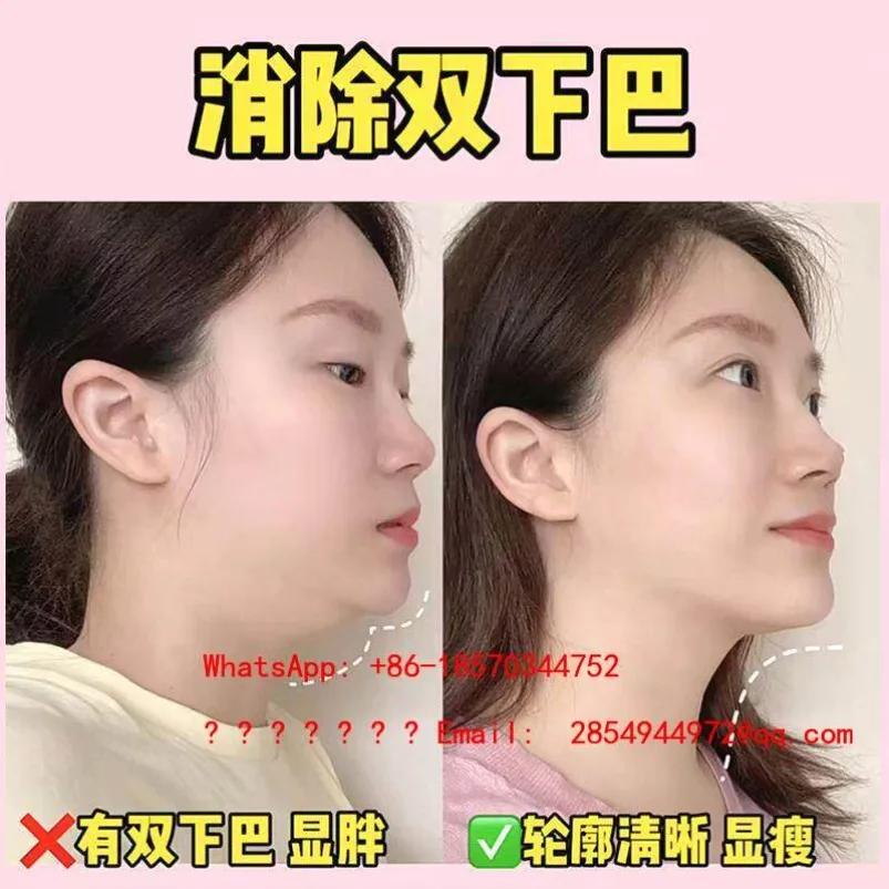 Double Chin Remover, Face-saving Artifact, Facial Lift, Removal of Excess, Jaw Line Exercise, Spot Quick Delivery