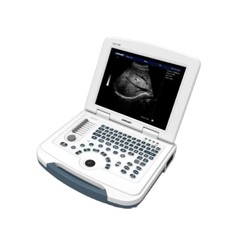 DW-580 low cost portable b/w ultrasound scanner & medical equipment