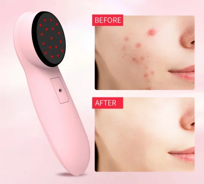 

Laser TreatmentsAnti-AgingAcne TreatmentsWrinkle ReductionFull Face Neck TreatmentsLaser Cosmetic Devices