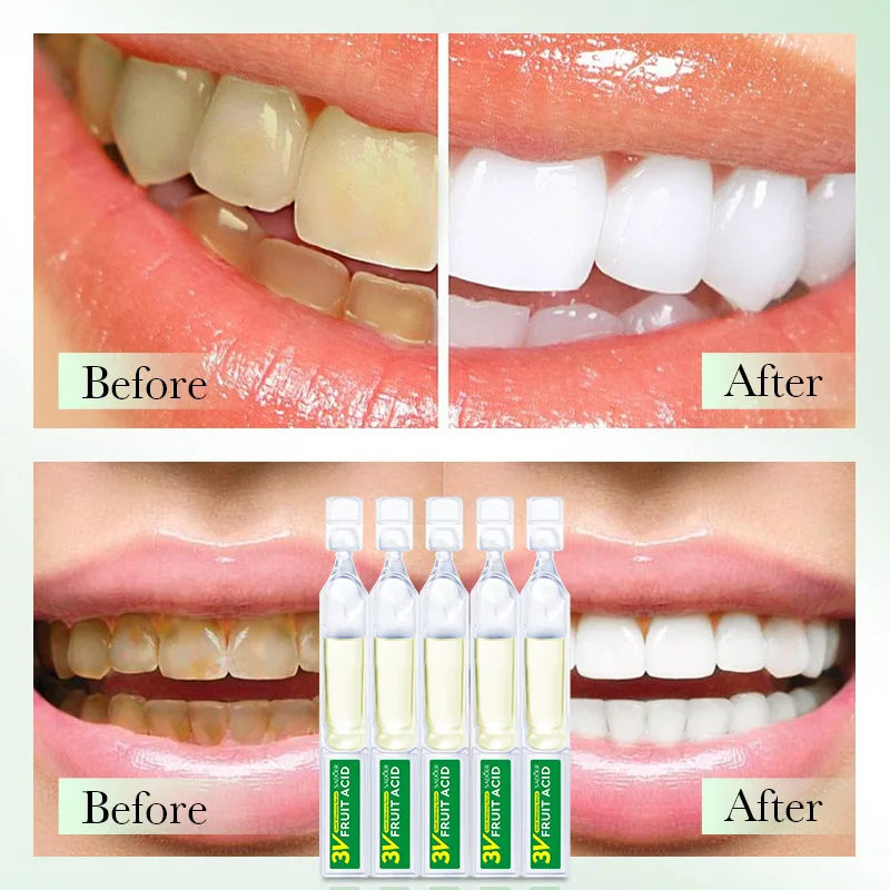 

10Pcs 3V Fruit Acid Teeth Whitening Serum Oral Cleaning Dental Stains Toothpaste Ampoule Tooth Serum Fresh Breath Tooth Care