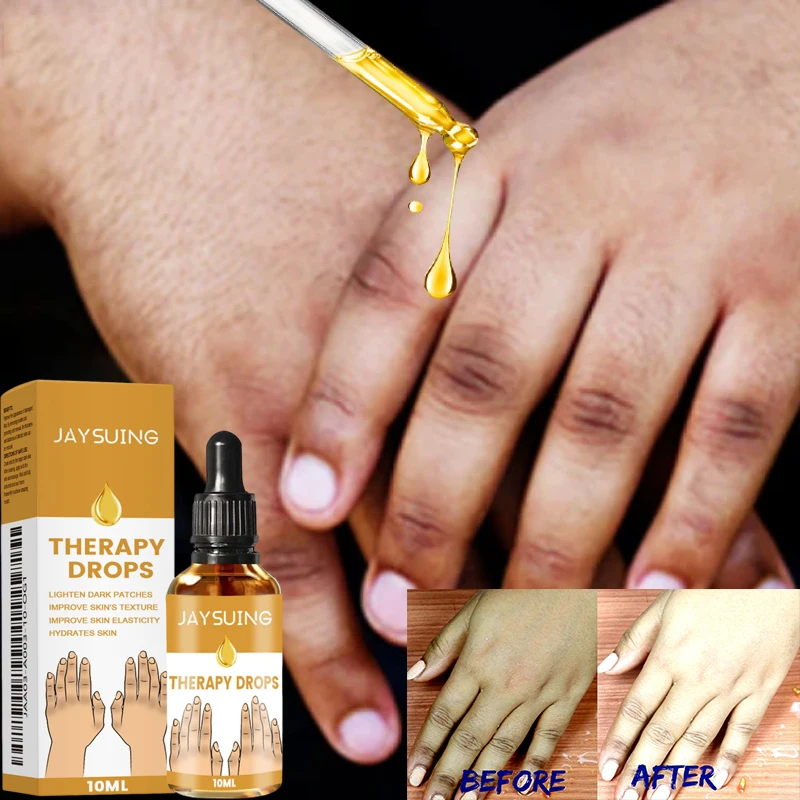 Fast Brighten Dark Knuckles Cream Whiting Hand Cream Lighten Melanin Stains Corrector Hand Anti Crack Soften Moisturize Product