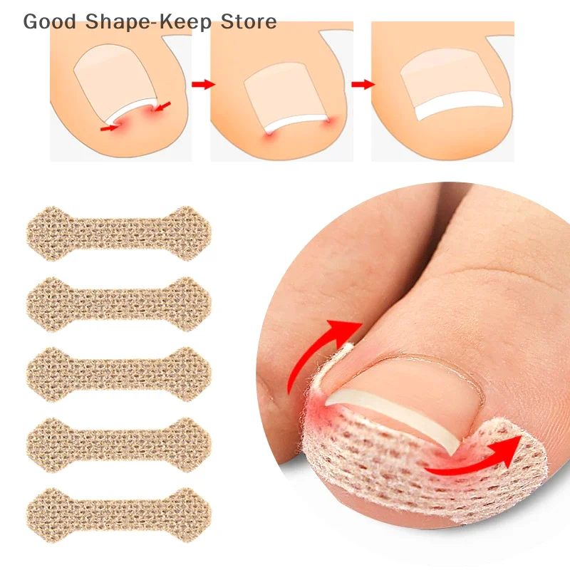 60 قطعة شرائط مصحح أظافر نام مكافحة مسمار التصحيح وسادة تو طويلة لداحس العناية بالقدم النوم مسمار التصحيح الأظافر في اللحم