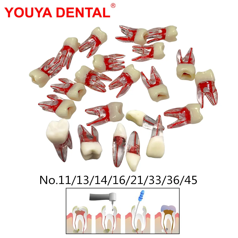 5pc Dental Endodontic Education Teaching Model Dental Cavity Model Training Endo Root Canal Block RCT Practice Resin Teeth Model