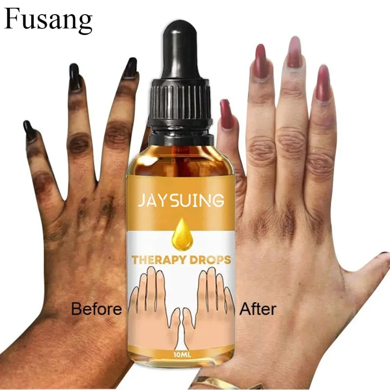 

Black Knuckles Fast Brightening Serum Hand Knuckle Elbows Knee Intense Stains Remover Essence Dark Skin Pigmentation Correctors