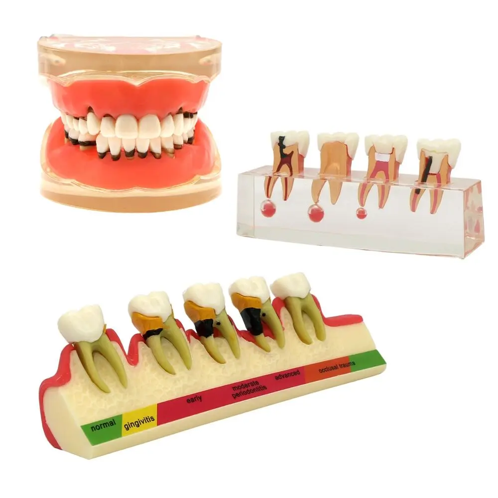 Dental Teeth Model Teaching Standard Implants Models Orthodontic Dentistry Dentist Demo Kilgore NISSIN 200/500,AG3,Columbia 860