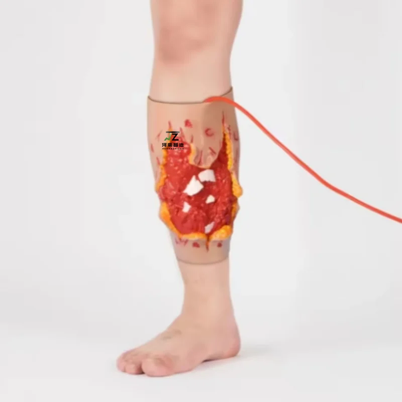 Wearable direct penetration burst wound model Combat wound burst hemostasis exercise trauma model