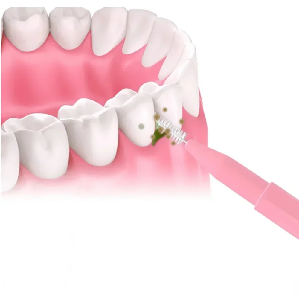 Interdental Brushes For Effective Teeth Cleaning & Oral Hygiene_voghion.com