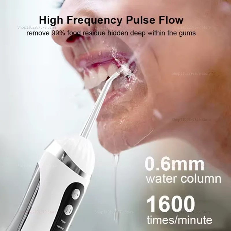 جهاز ري الفم المحمول 3 وضع التنظيف IPX7 مقاوم للماء، منظف الأسنان القابل لإعادة الشحن من النوع C 4 فوهة غسول الفم عالي الضغط