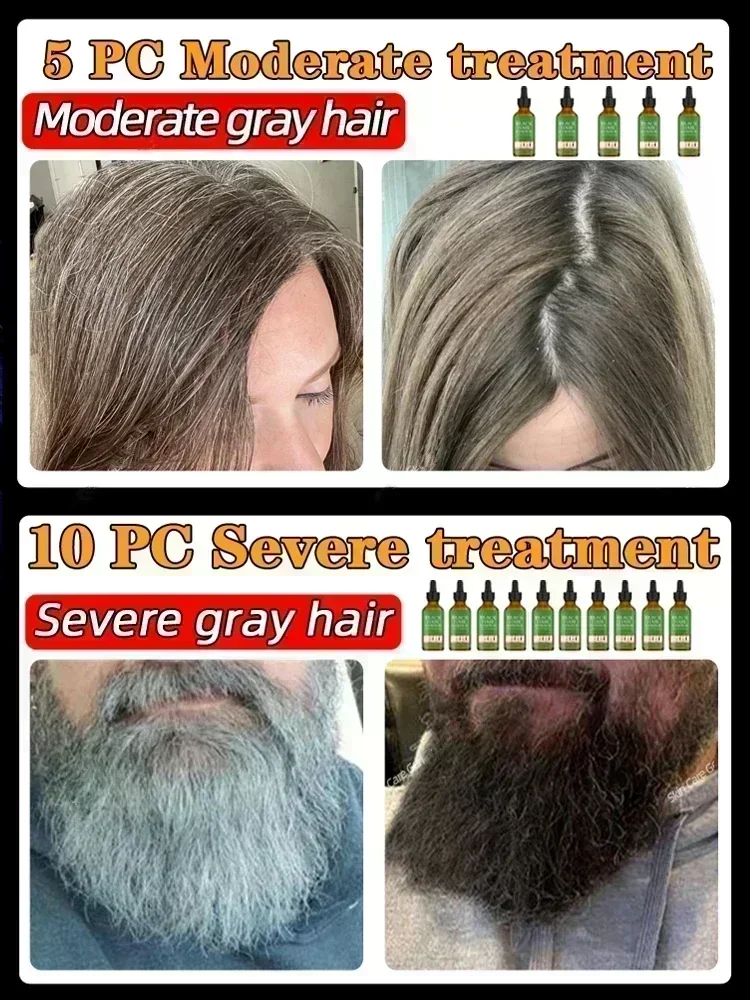 HOT SALE Black Hair Liquid Removes Grey Hair in Old Age Natural Anti-white Ahair Effective for Natural Ahair Color and Restore B