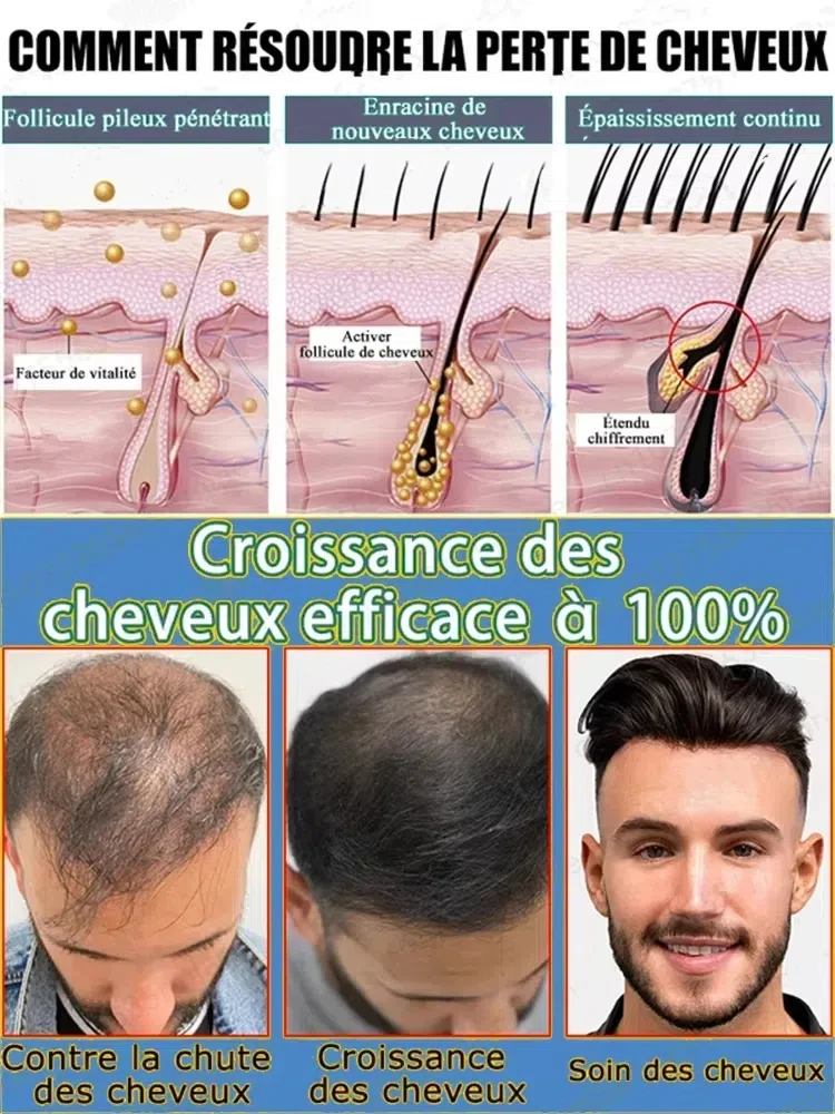 25 HT Awaken Dormant Follicles for Abundant Hair