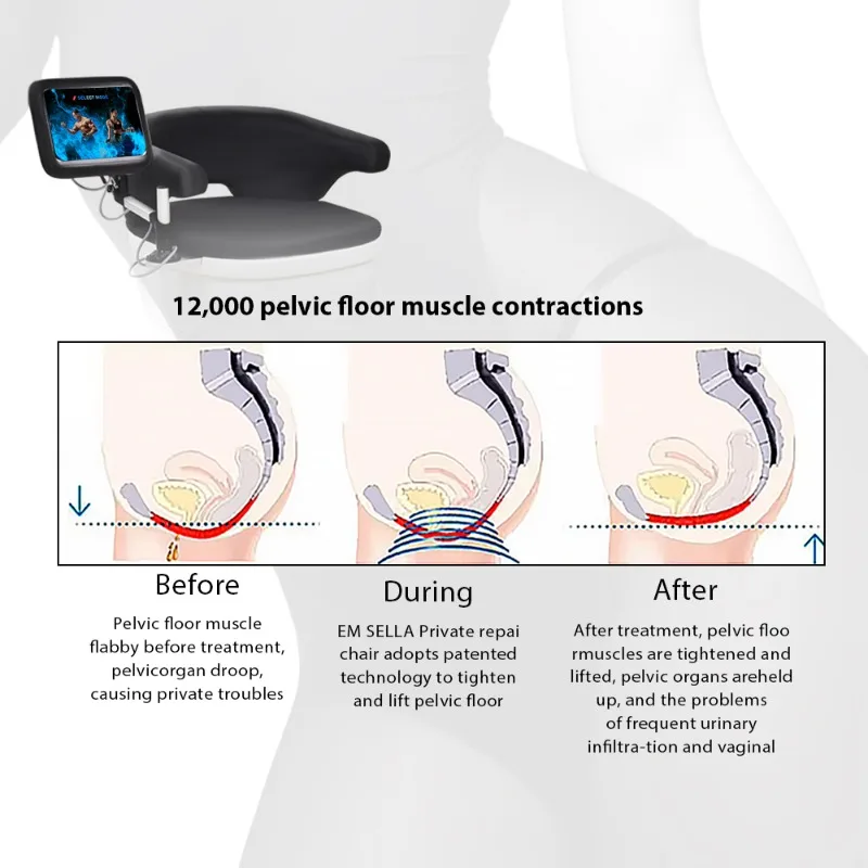 Postpartum Recovery Magnetic EMS Standing Chair for Pelvic Floor Muscle Strengthening and Urinary Incontinence Therapy