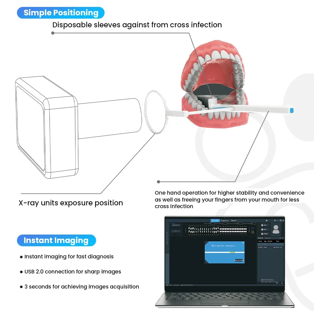 Escáner intraoral HD de rayos X dental para clínica veterinaria - imagen 5