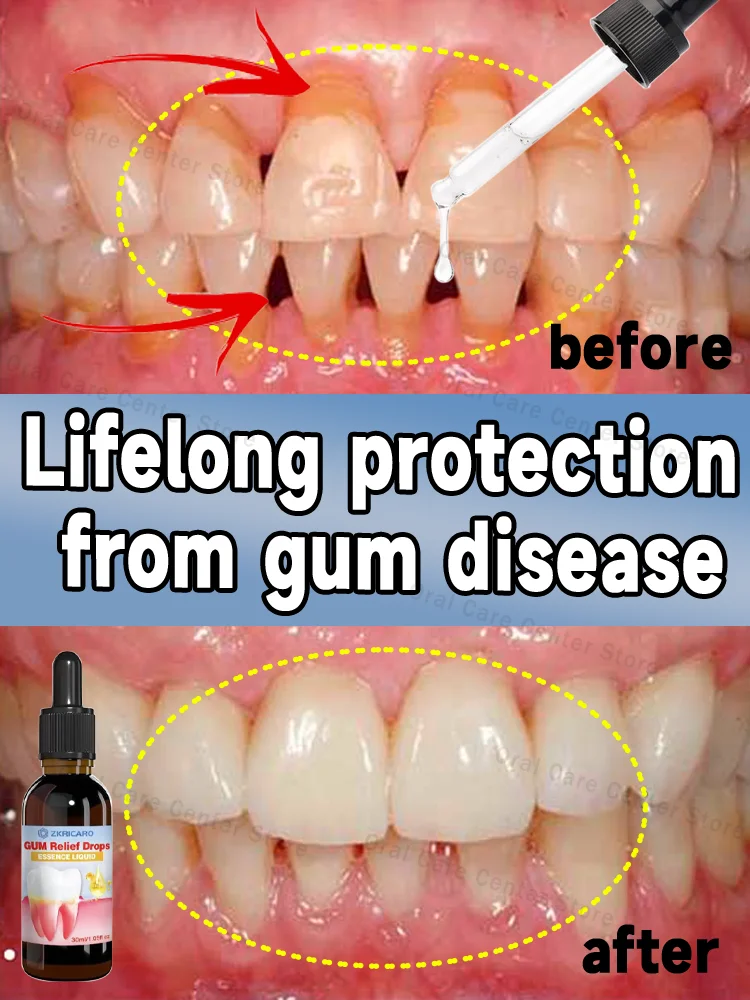 Effectively repair damaged gums, relieve toothache