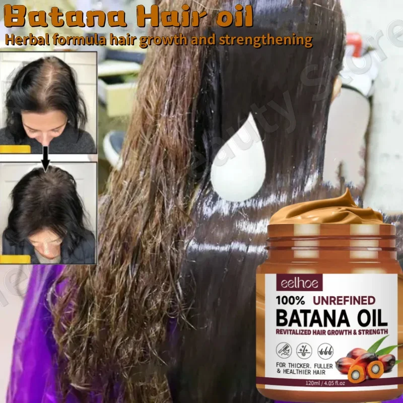 Huile de Batana 100% Biologique pour la Croissance des Cheveux, Traitement Contre la Perte, Anti-installation, Renforce les Racines, Soins Capillaires pour Femme, 120ml