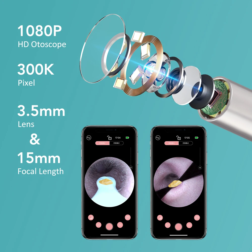 Smart Visual Ohr reiniger Set mit Kamera 1080p Ohr stöpsel Ohrenschmalz entfernungs werkzeug WLAN-Verbindung HD LED-Lichter Ohr stöpsel Endoskop – Detail 3