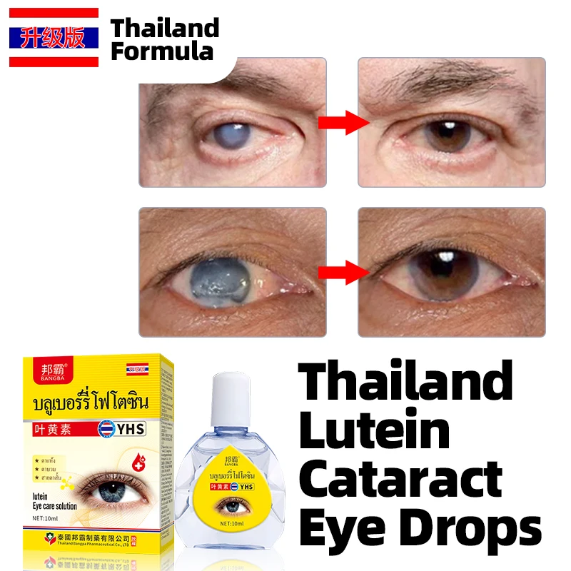 

Cataract Removal Treatment Eye Drops Apply To Eyes Pain Dry Itchy Fatigue Vision Care Cleaner Lutein Medicine Thailand Formula