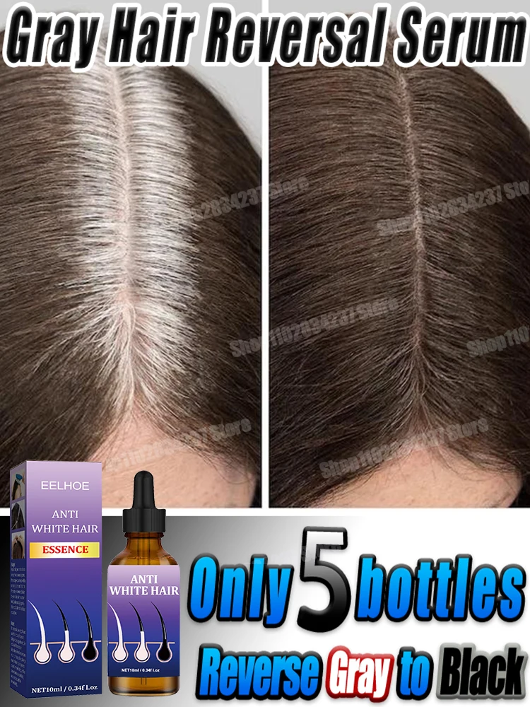 مكافحة الشعر الرمادي الأبيض إلى الأسود اللون الطبيعي إصلاح تغذية مكافحة فقدان الرعاية للرجال والنساء