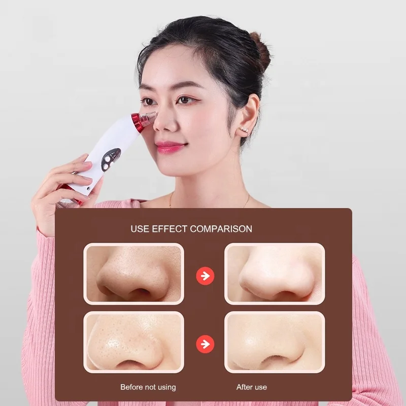 متعددة الوظائف فراغ مزيل الرؤوس السوداء قابلة للشحن نانو الوجه ضباب البخاخ الكهربائية الوجه باخرة #5