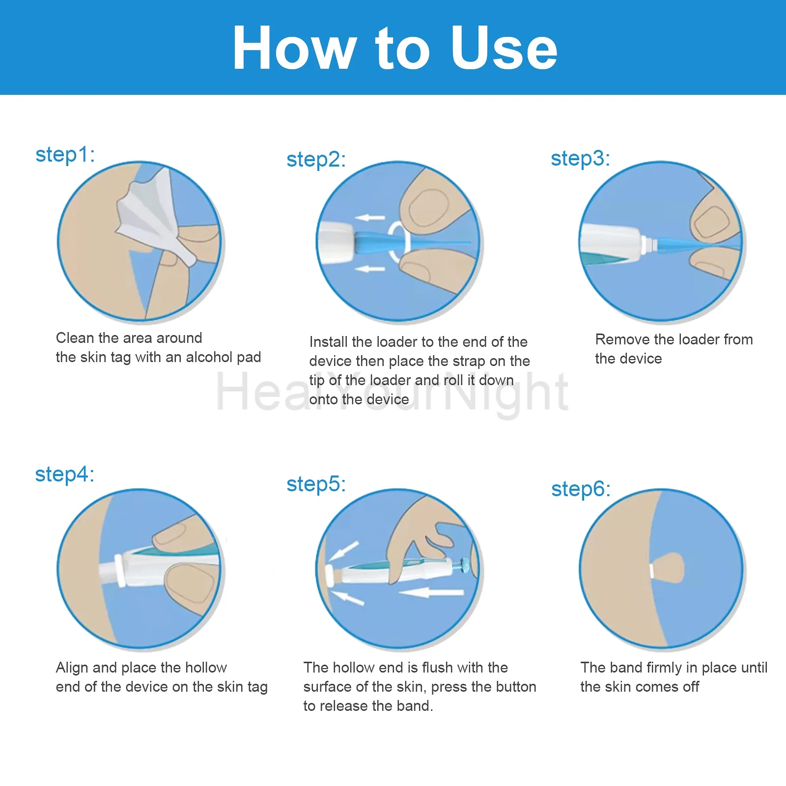 3 In1 Indolore Auto Tag Pelle Talpa Verruca Kit di Rimozione Strumenti di Pulizia Viso Cura Della Pelle Corpo Verruca Dot Trattamenti Rimozione Bellezza Salute
