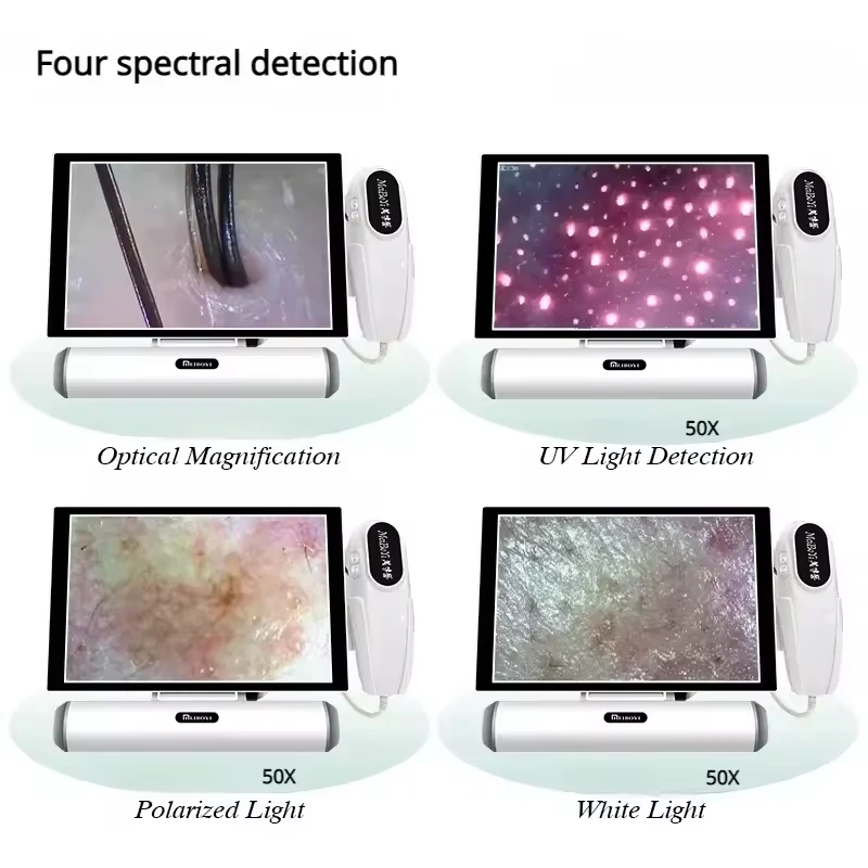 محلل جلد فروة الرأس كاشف بصيلات الشعر مجهر فروة الرأس 4 الطيفية 5G WIFI ماسح الشعر التطبيق التشخيصي أرشيف العملاء #2