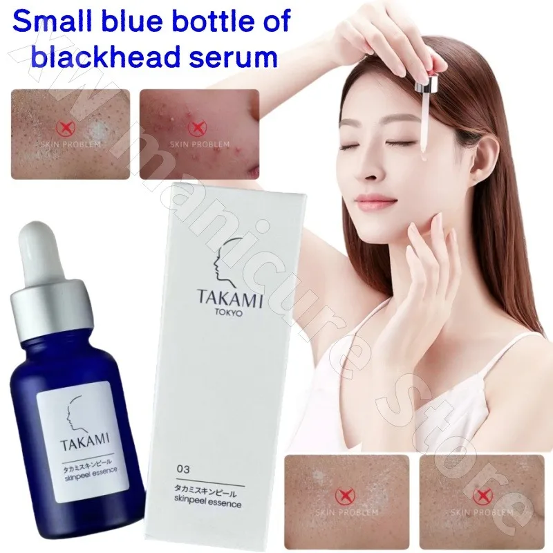 Japanese Small Blue Bottle Essence 30ml Facial Removal and Mouth Blackhead Acne Shrinking Pores Softening Keratin Moisturizing