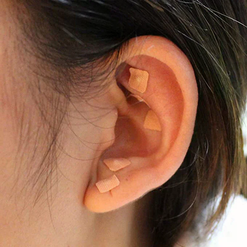 In 1 Set Multi-Condition Ear Seeds Acupuncture Auricular Sticker Kit 1200pcs With Acupressure Chart Tweezer Auricular Probe 4