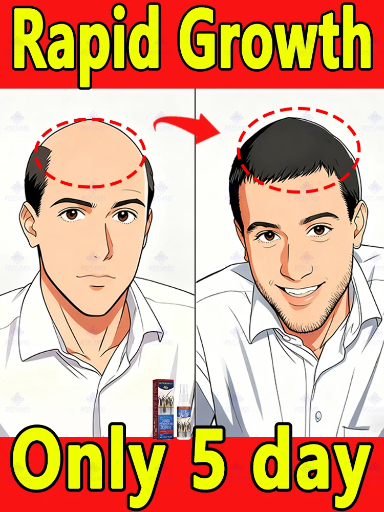 

Покрашенная находка для корней плотностью