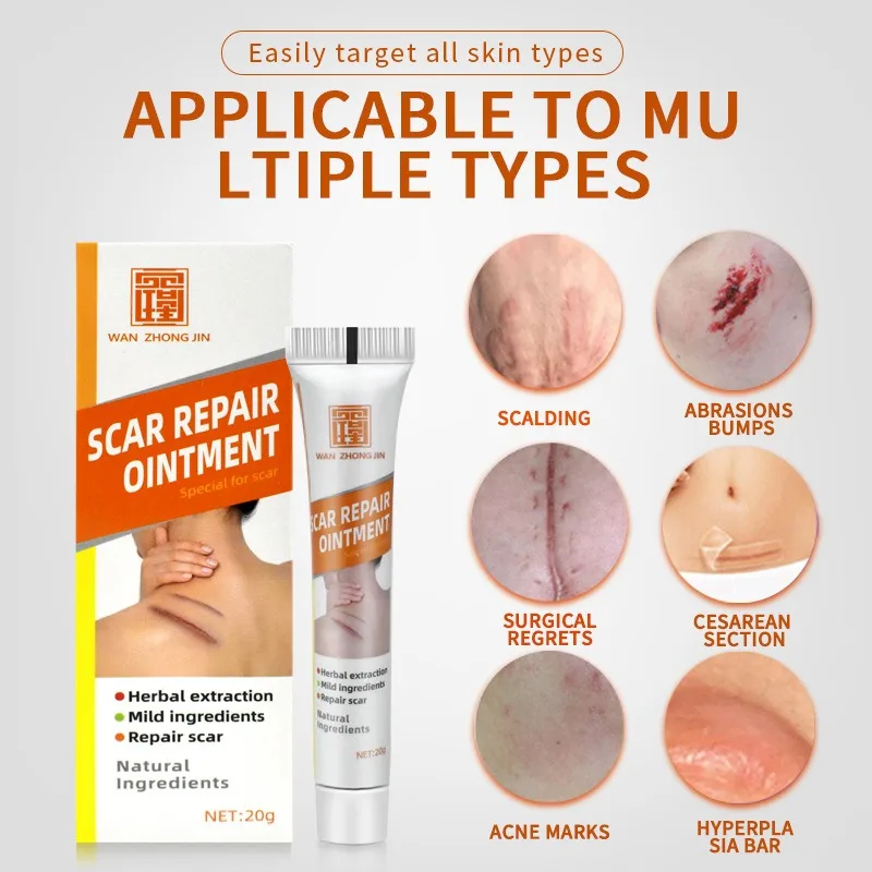 

Травяная мазь от шрамов для женщин, послеоперационные послеродовые шрамы от ожогов, гель от шрамов, успокаивает и восстанавливает